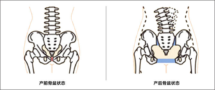 女性生产时的盆骨